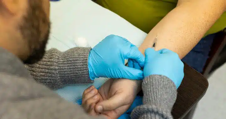 Mpox vaccine is 58% effective after one dose, Canadian study finds – National