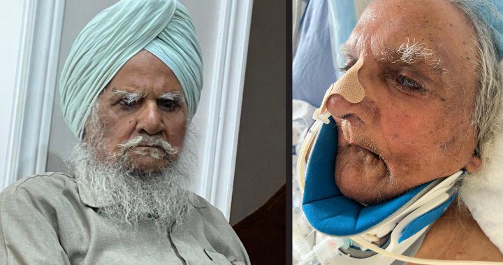 Hospital shaving elderly Sikh patient without consent ‘cannot happen again’: WSO